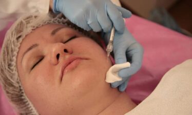 A woman is treated with Restylane Lyft
